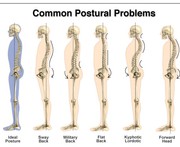 Best Back Pain Specialist in Melbourne